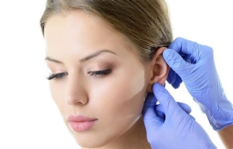 chi phí phẫu thuật tạo hình vành tai